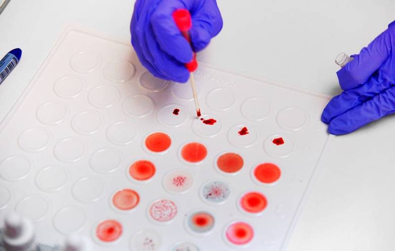 У людей с какой группой крови самый сильный иммунитет и крепкое здоровье, выяснили учёные