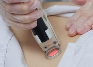 Как подготовиться к эпиляции александритовым лазером: советы и рекомендации